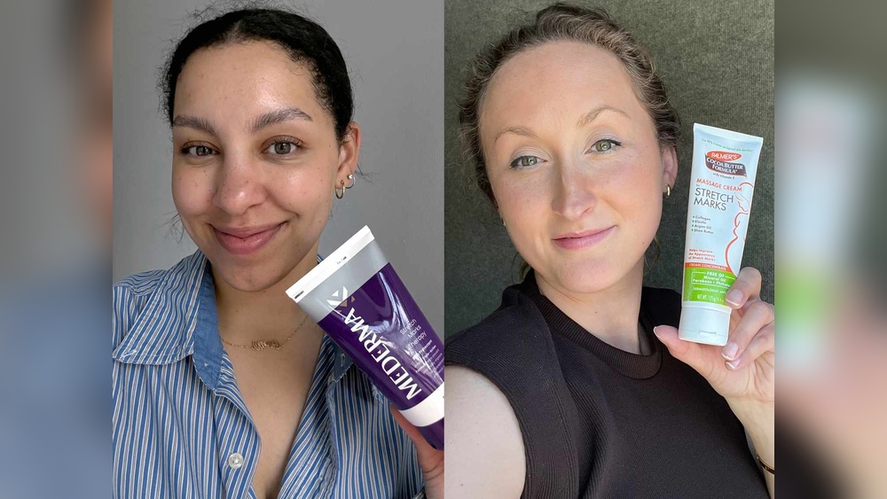 Best Stretch Mark Creams That Actually Work
