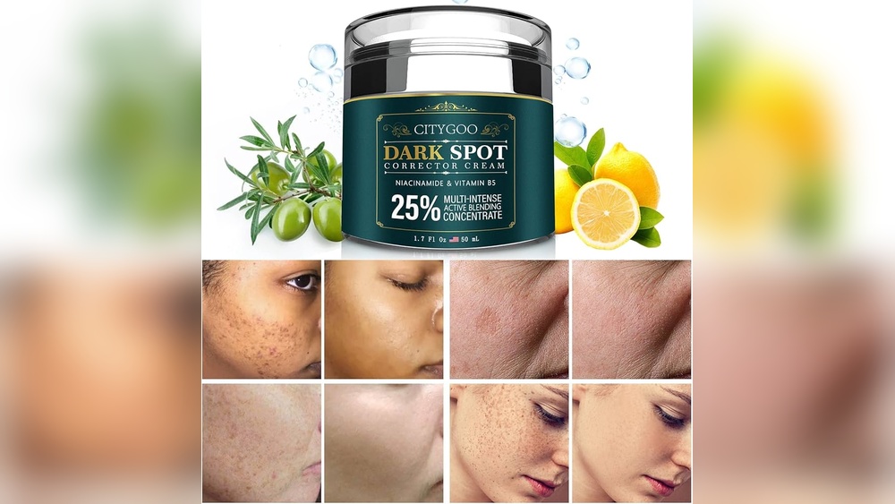 Best Creams to Prevent Sun Spots: Top Effective Solutions Revealed